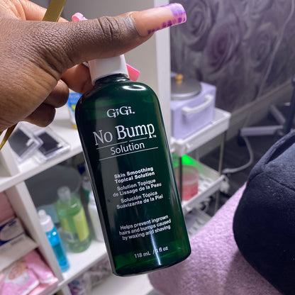 GiGi’s No Bump Solution image 0